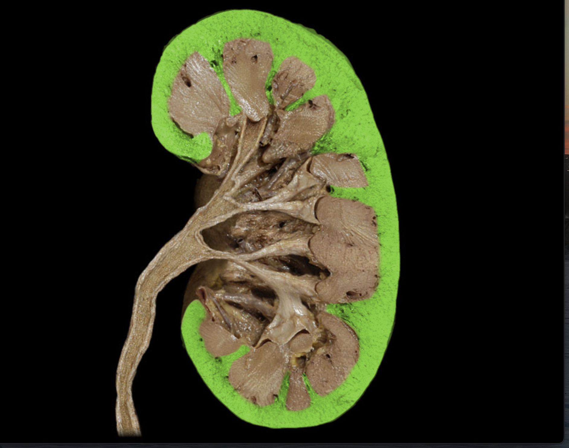 <p>Middle layer of kidney</p>