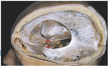<p>Dura mater</p><p>FFT</p><p>Identify the two folds of the three in the diagram</p>
