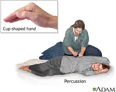 <p>striking the chest with <strong>cupped</strong> hands to loosen secretions</p>