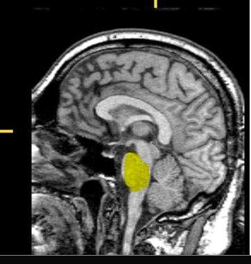 <p>What part of the brain is highlighted?</p>