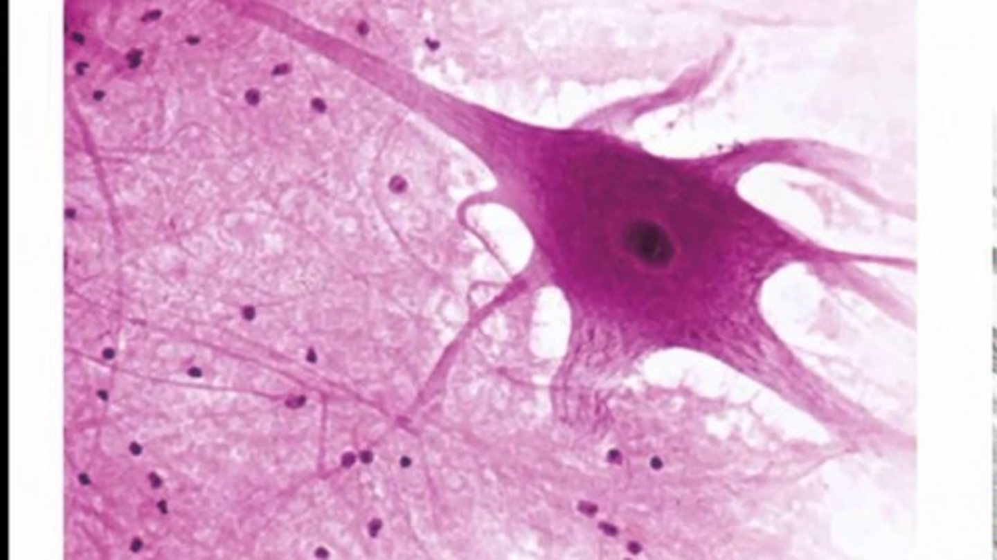 <p>Nervous tissue</p><p>Cell nucleus</p><p>nucleolus</p><p>cytoplasm</p><p>processes (axon/dendrite)</p><p>Glial nucleus</p>