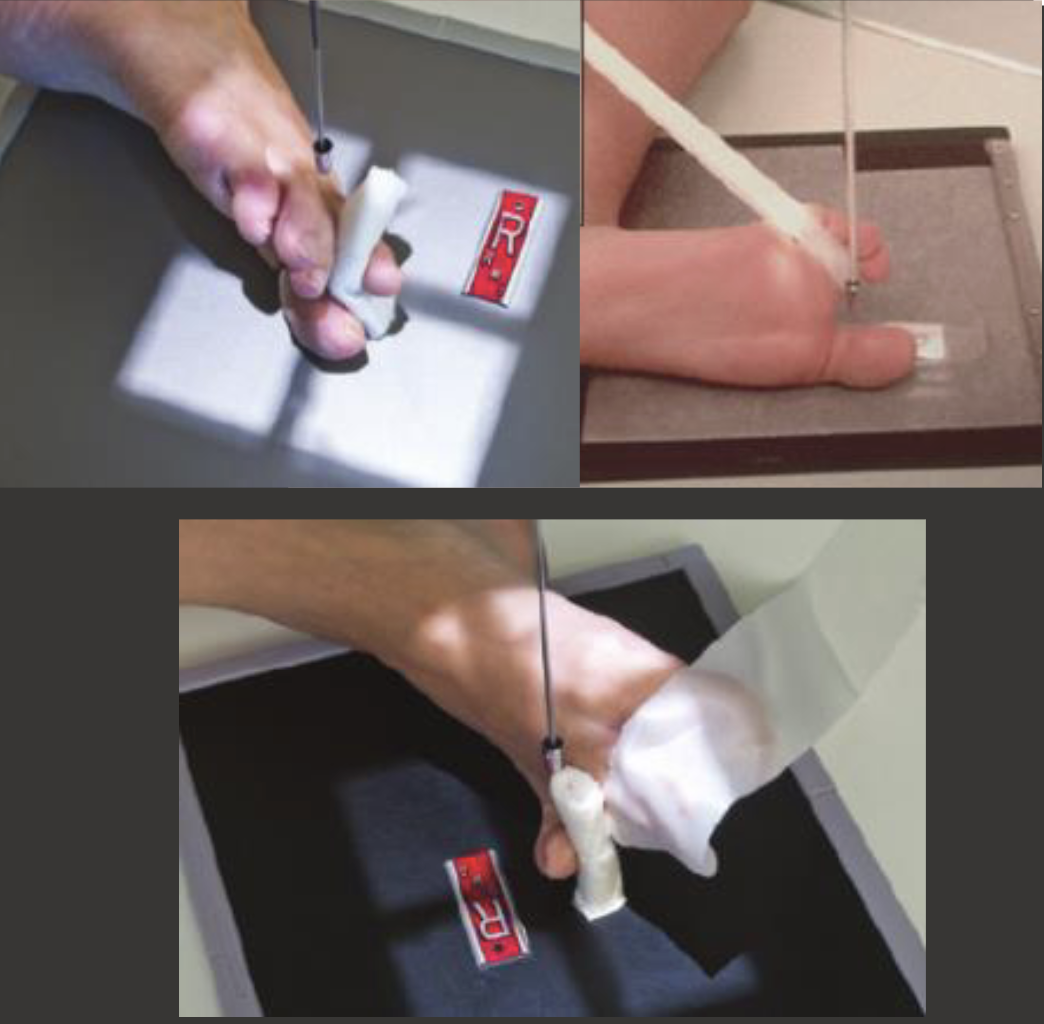 <p>Fine FS, 100cm</p><p>55kVp, 1mAs</p><p>Straight tube</p><p>CR: Metatarsophalangeal joint</p>