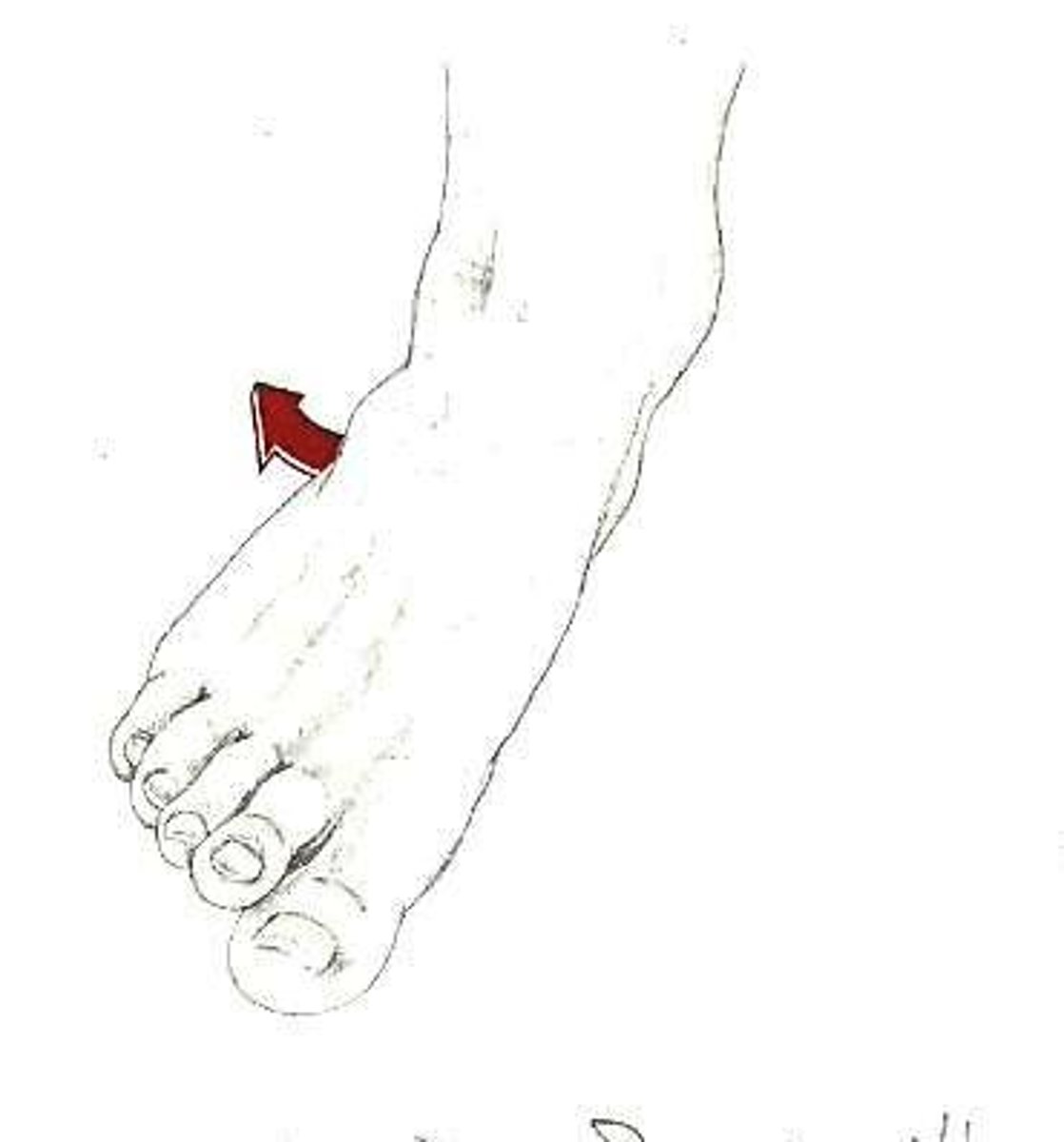 <p>this is an example of what muscle action?</p>