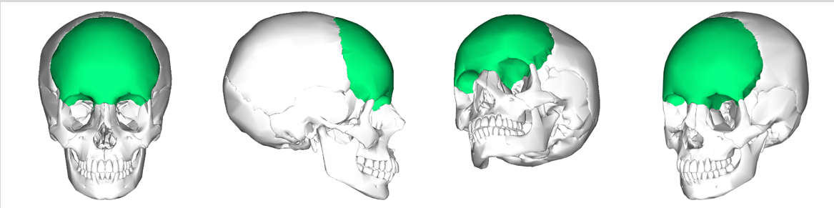 <p>Can you name what each view is of the frontal bone of the cranium?</p>