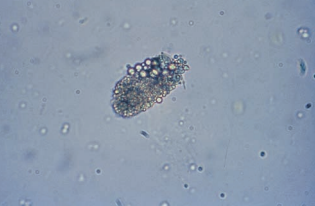 RTE cells with granules and fat globules