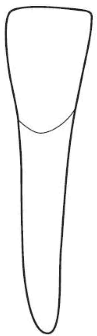 <p>what is the outline forms for the mesioincisal angle for the mandibular right lateral incisor?</p>
