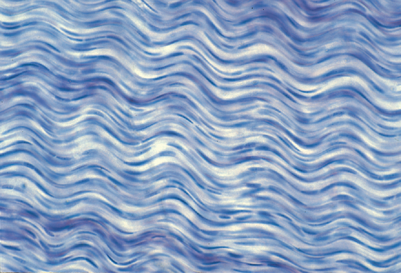 <p><span style="color: blue"><strong>Regular</strong></span><strong> Dense Connective Tissue </strong></p>