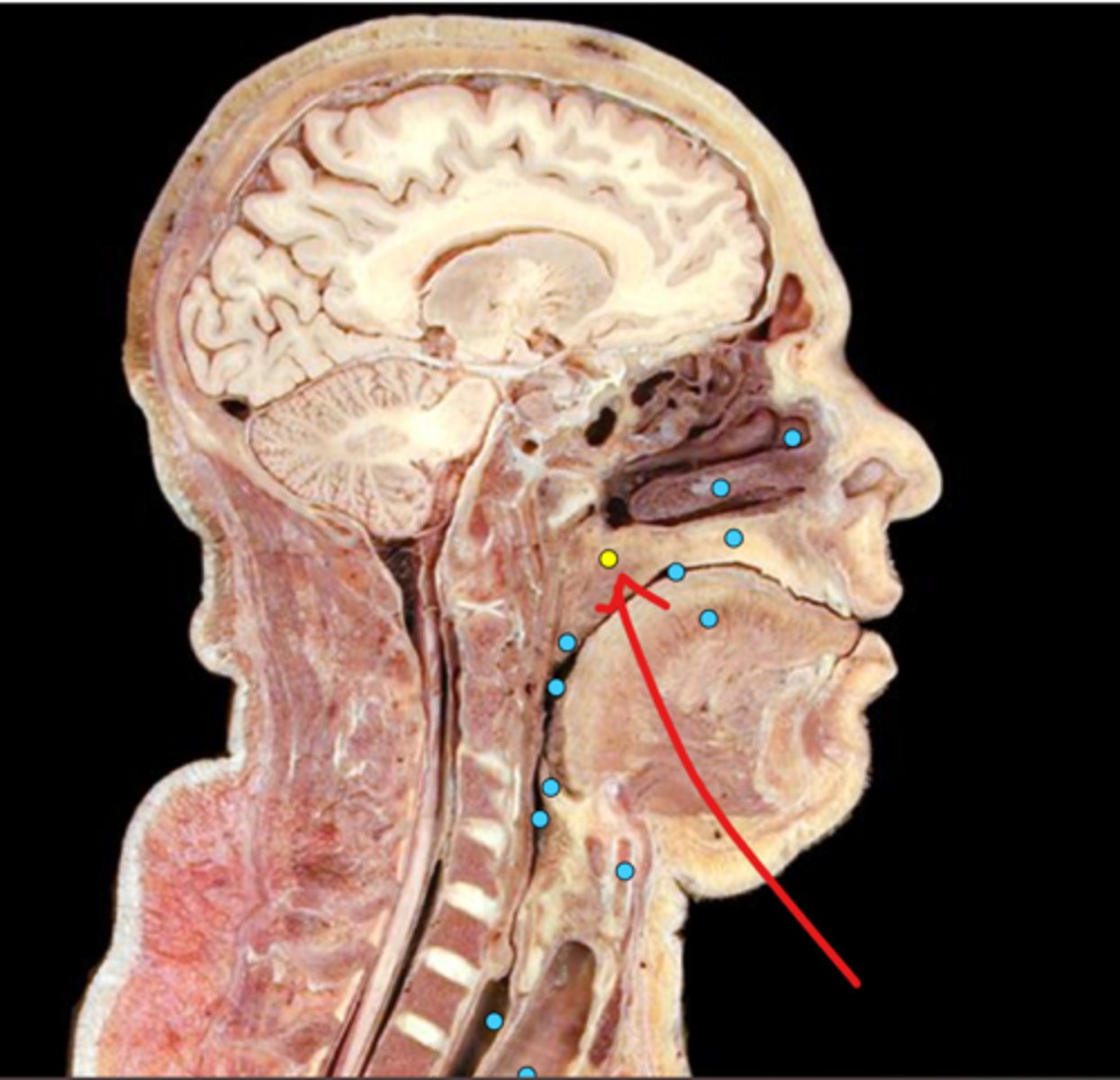 knowt flashcard image