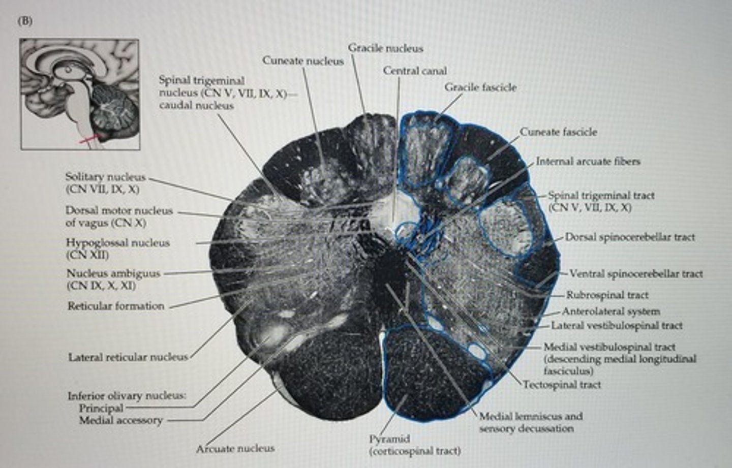 <p>axons of the second order sensory neurons that compose the gracile and cuneate of the medulla</p>