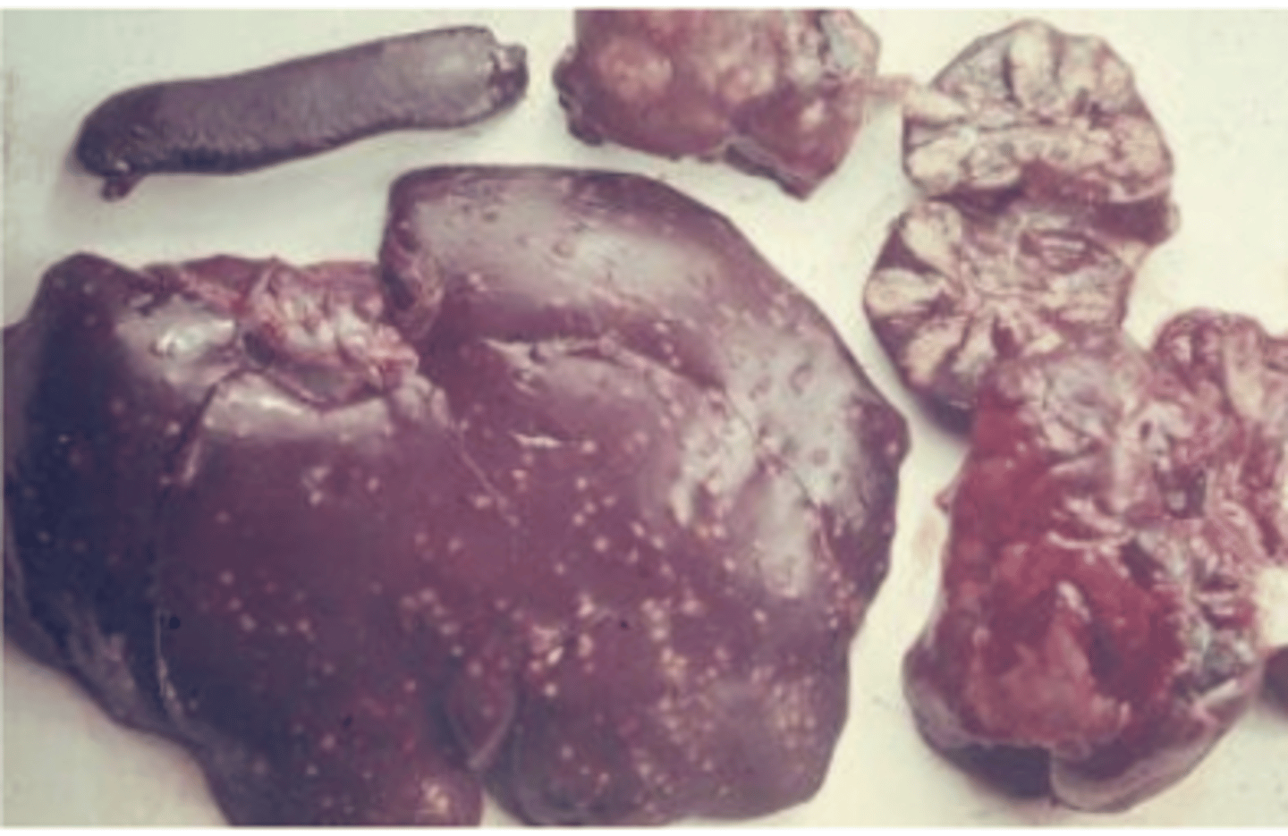 <p>what enterobacteria causes these granulomas?</p>