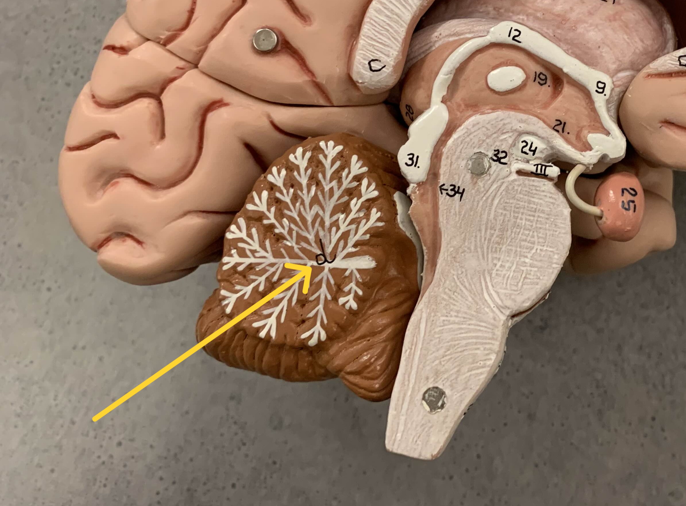 <p>Which part of the cerebellum is:</p><ul><li><p>White tree-like pattern</p></li></ul><p></p>