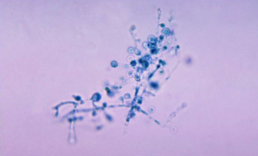 <p><span style="color: rgb(255, 255, 255);"><span>Blastomyces dermatitidis</span></span></p>