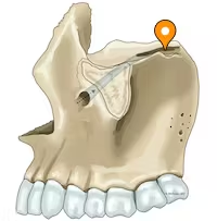 <p>posterior half of orbital floor, connects with infraorbital foramen through the infraorbital canal</p>