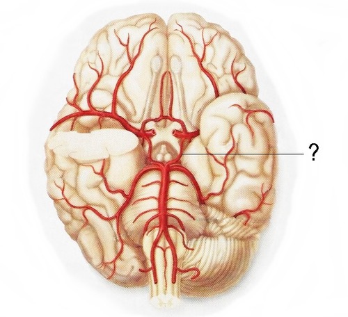 <p>connects right and left anterior cerebral arteries</p>