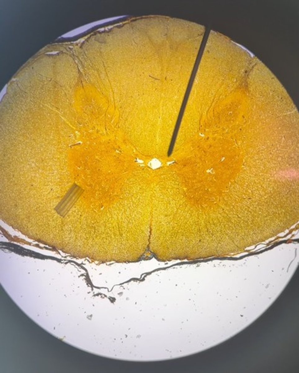 <p>1. What is the structure at the pointer?</p><p>2. What is the hole in the center near the pointer?</p><p>3. What is the lighter area of white matter above the pointer?</p><p>4. What is the lighter area of white matter below the pointer?</p>