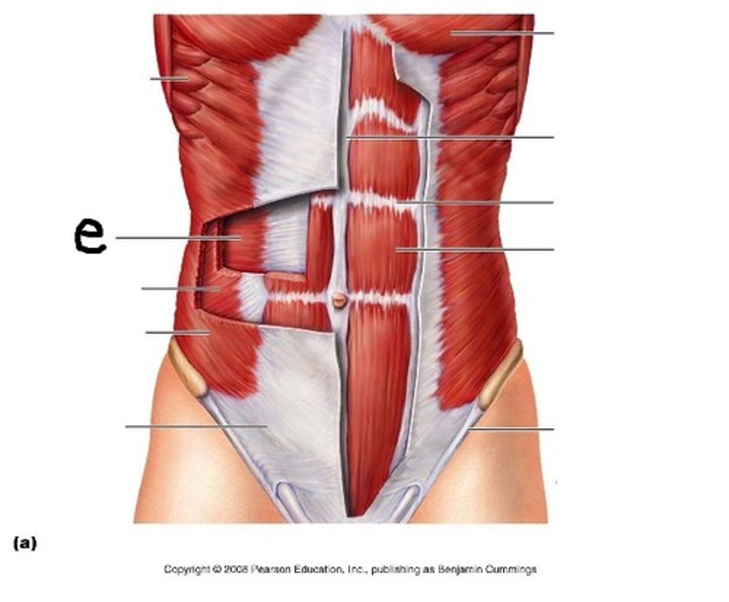 <p>Deepest abdominal muscle, this muscle compresses the abdomen (waist) or fixates the waist. Horizontal</p>
