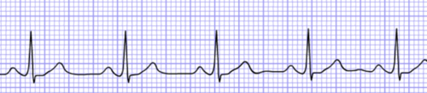 <p>Name the rhythm</p>