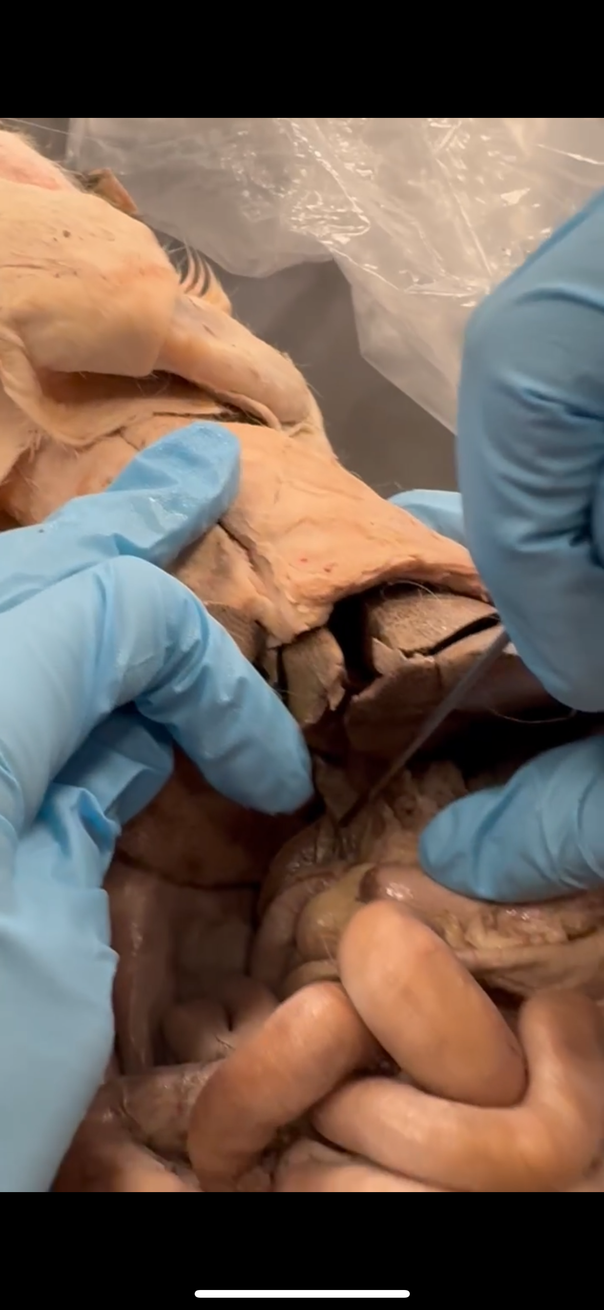 <p>connection of cystic and hepatic</p>