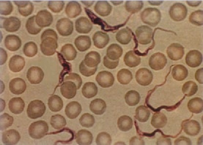 <p>The organism pictured belongs to phylum:</p><ul><li><p>Euglenozoa</p></li><li><p>Apicomplexa</p></li><li><p>Foraminifera</p></li><li><p>Radiolaria</p></li></ul><p>And what is the organism?</p>