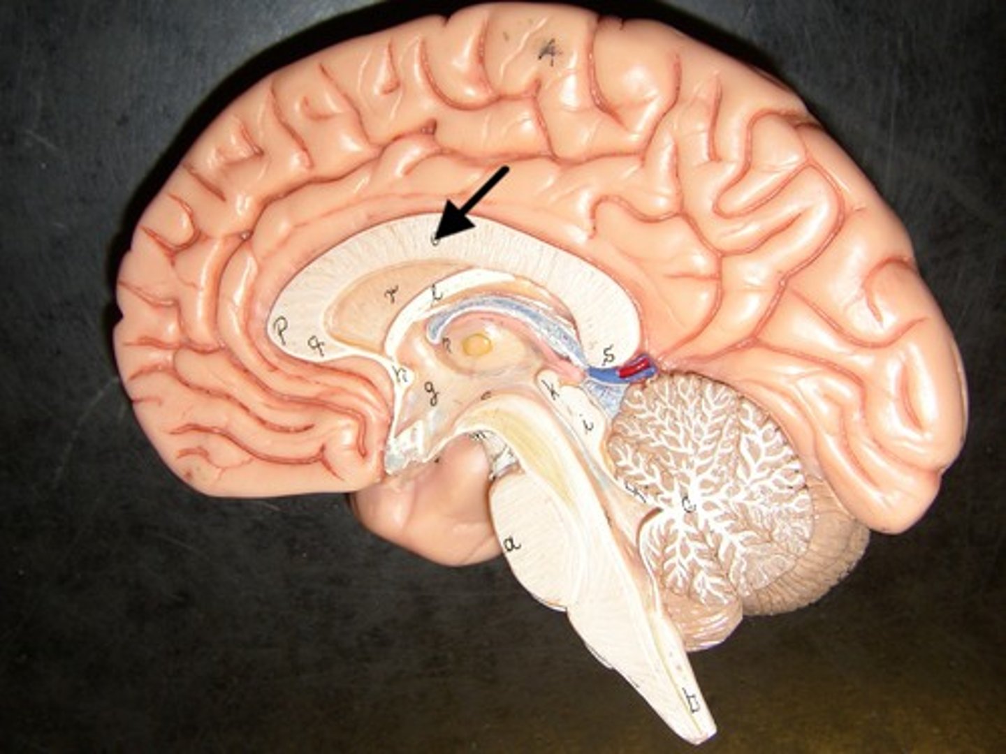<p>A thick band of nerve fibers that connects large areas of the cerebral cortex on each side of the brain and supports communication of information across the hemispheres.</p>