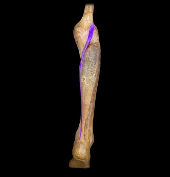 <p>IDENTIFY THIS MUSCLE</p>