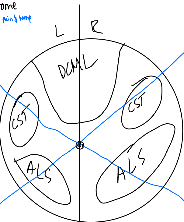 <p>What’s damaged? What are the 2 types of lesion? </p><p>What’s affected for both lesions? </p><p>What are the 2 tips?</p>