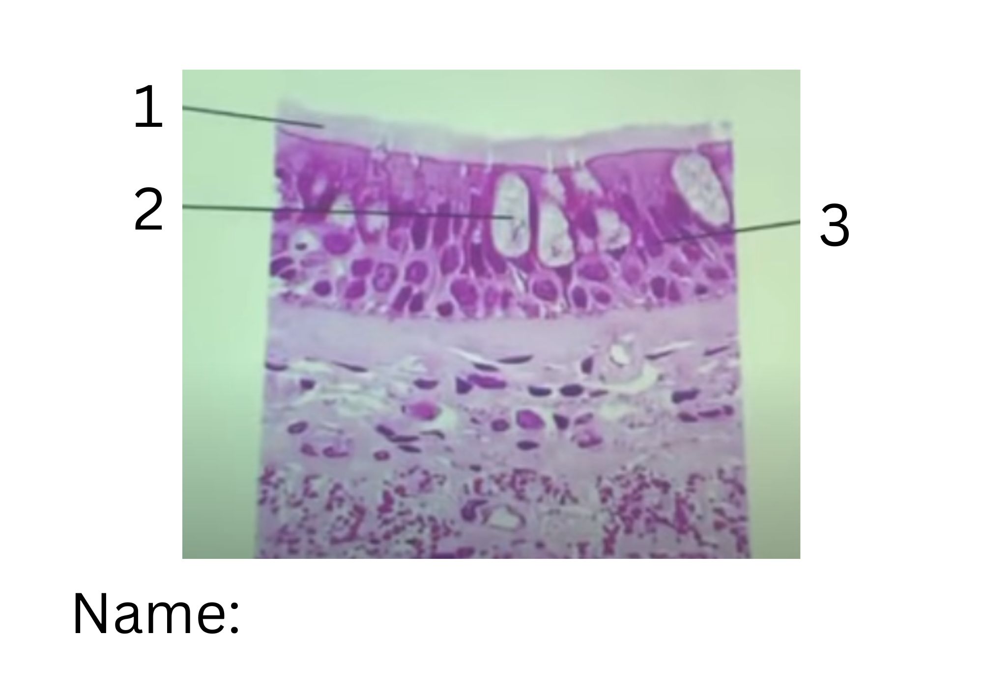 term image