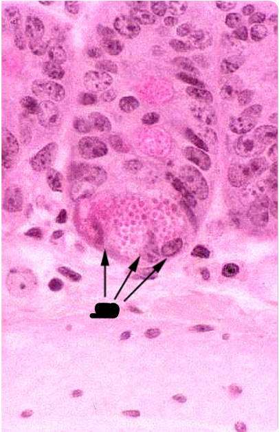 <p>the arrows point to</p>