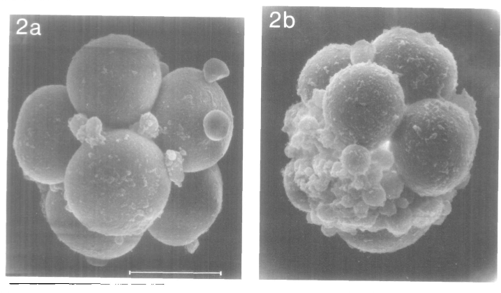<p><span>Due to uneven division of the cells</span></p><p style="text-align: left"><span>Cytoplasmic debris</span></p><p style="text-align: left"></p><p style="text-align: left"><span>Higher fragmentation = lower likely hood of pregnancy</span></p><p></p>