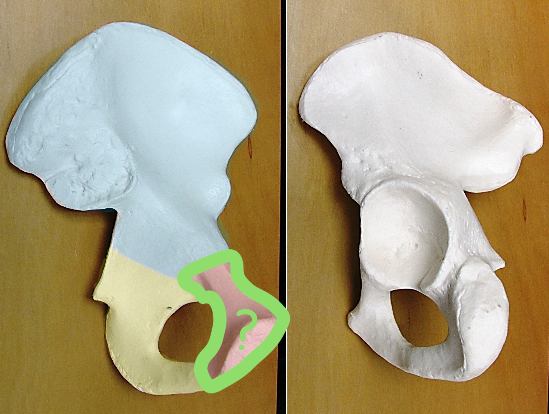 <p>Determine the part of the Coxa highlighted</p>