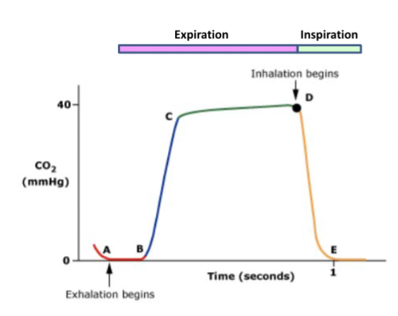 <p>Capnography</p>