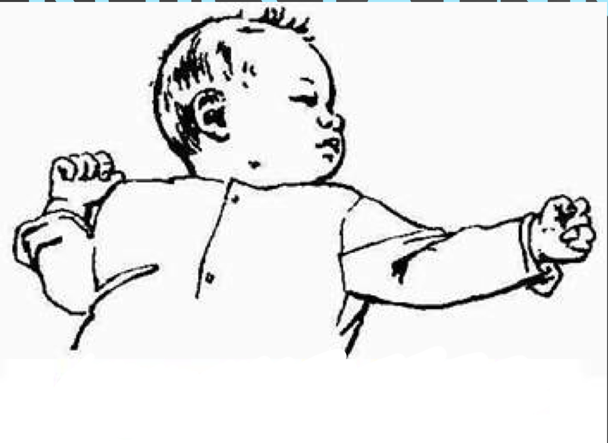<p>This is an example of what reflex…</p>