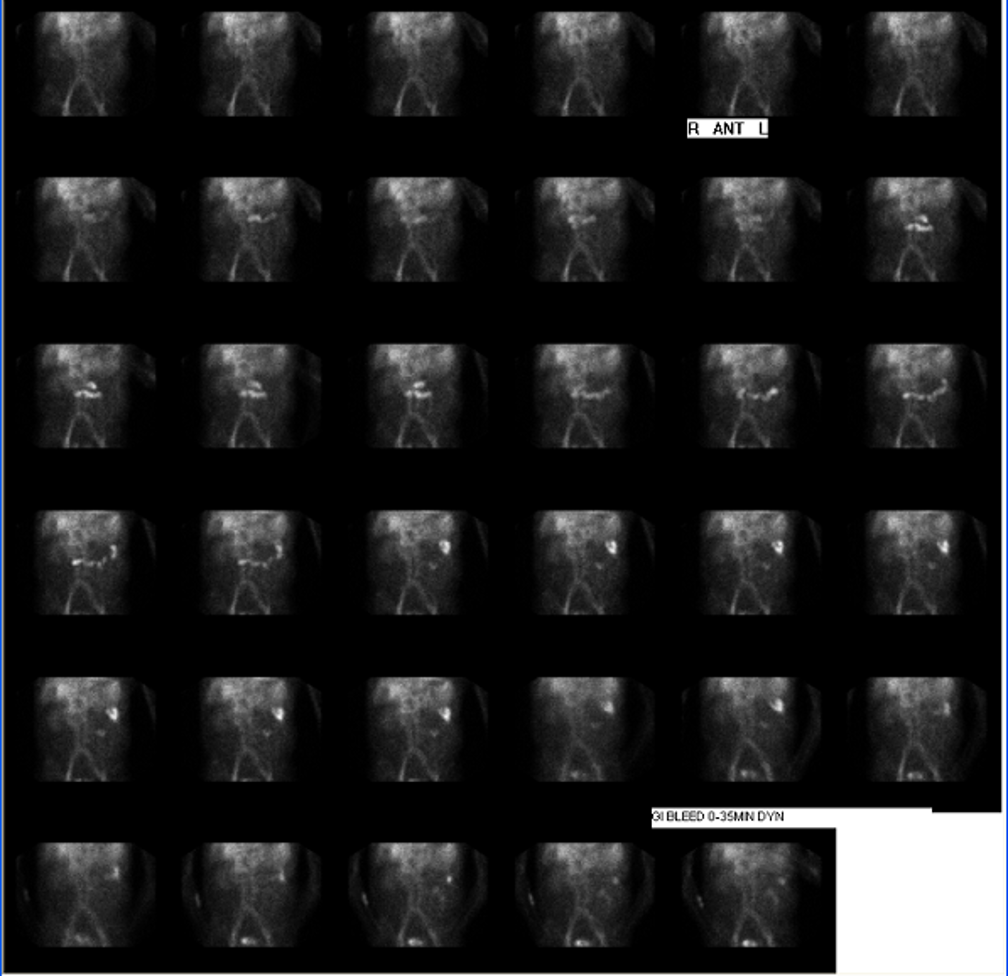 <p>what is this pictuer showing?</p>