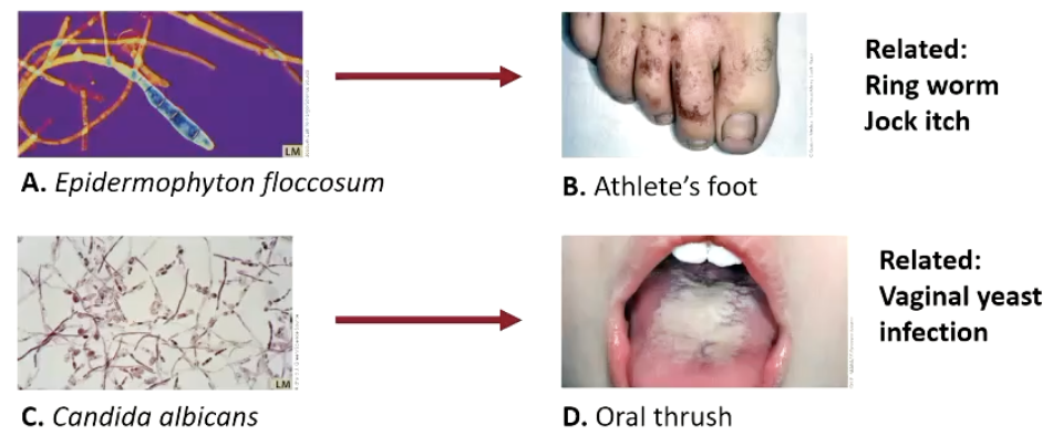 <ul><li><p>Fungi are <strong><em>less</em></strong> likely to cause disease in humans but can do so in <strong><em>immunocompromised individuals.</em></strong></p></li></ul><p></p>