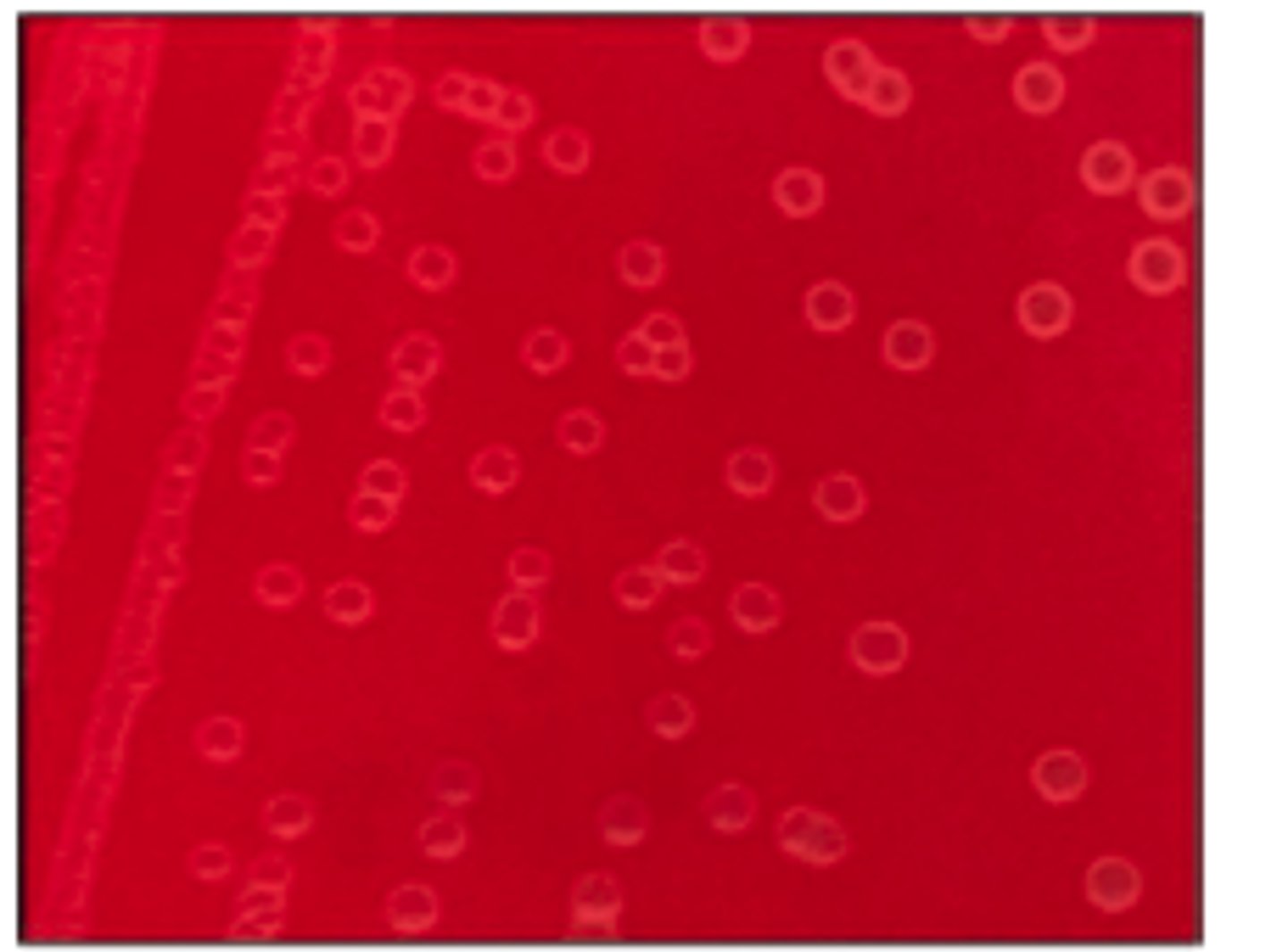 <p>The organism on the BA plate provided was isolated from a milk specimen of a Holstein</p><p>cow with acute mastitis. The organism did not grow on MAC.</p><p>Is there hemolysis? If so, what type?</p>