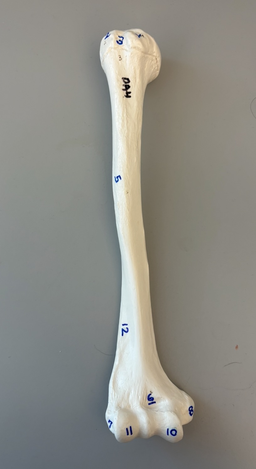 <p>What is this bone</p>