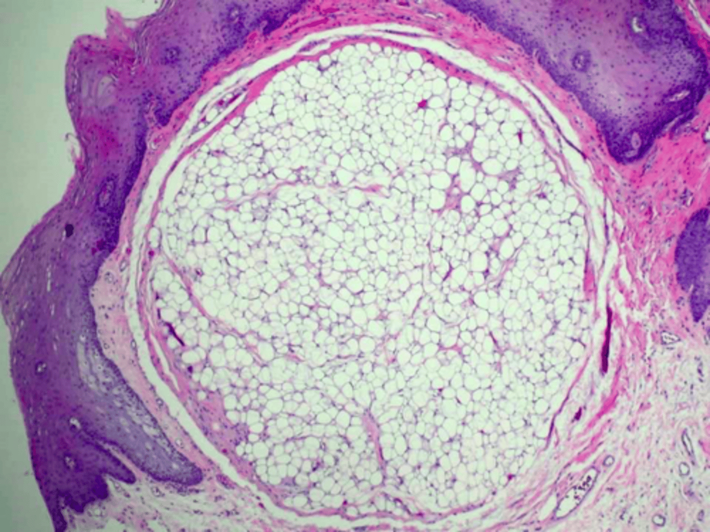 <p>ID the pathology:</p>