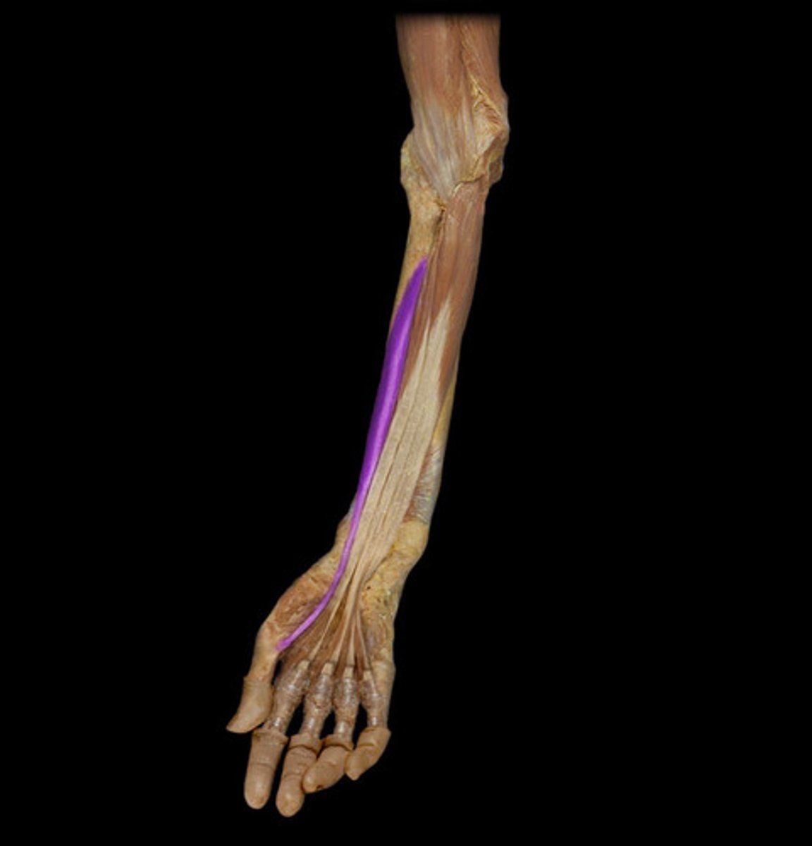 <p>Origin: Anterior surface of radius and interosseous membrane</p><p>Insertion: Base of distal phalanx of thumb</p><p>Action: Flexes thumb (IP and MCP joints)</p>