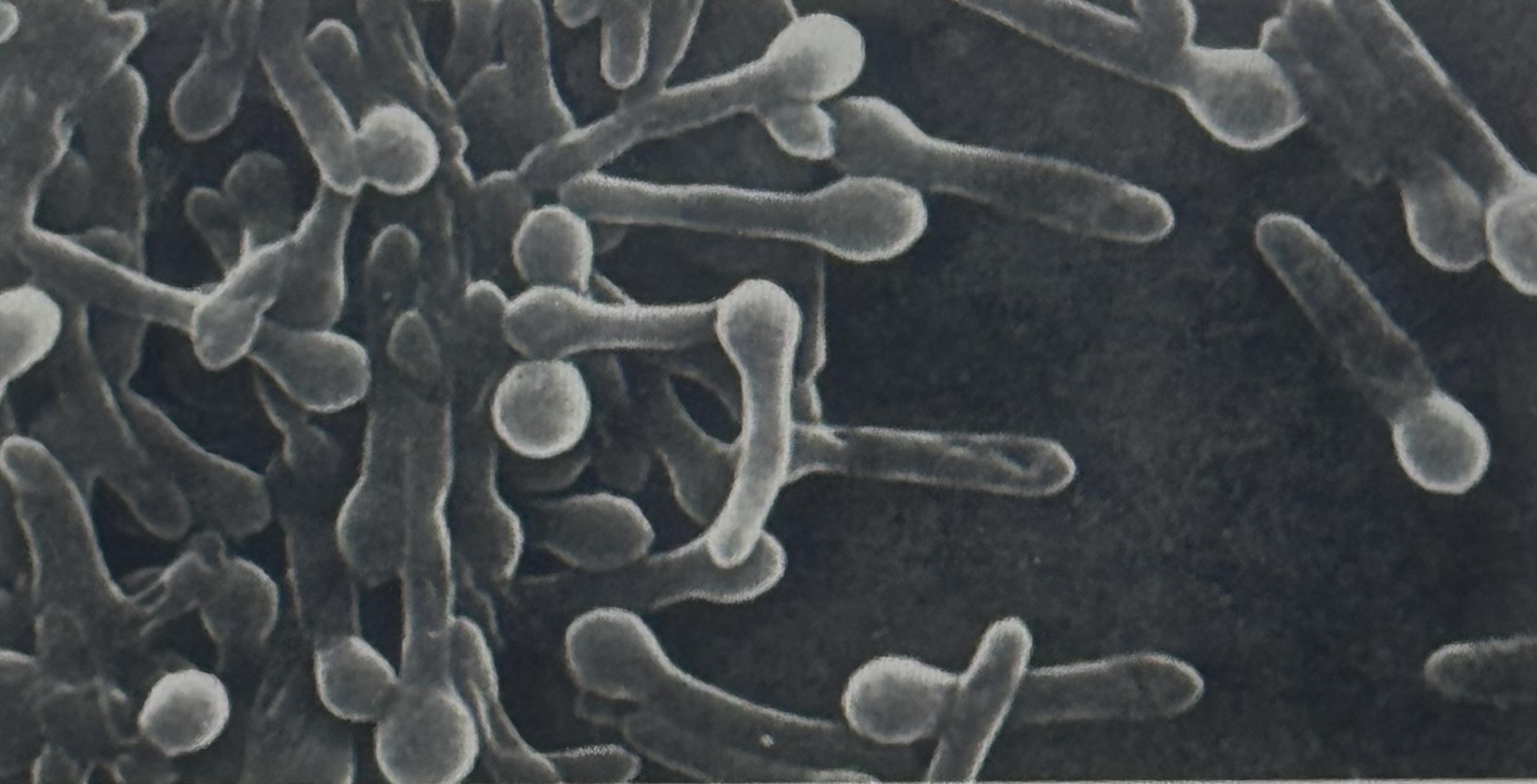 <p>Chlostridien: Chlostridium tetani, C. botulinum Steckbrief</p>