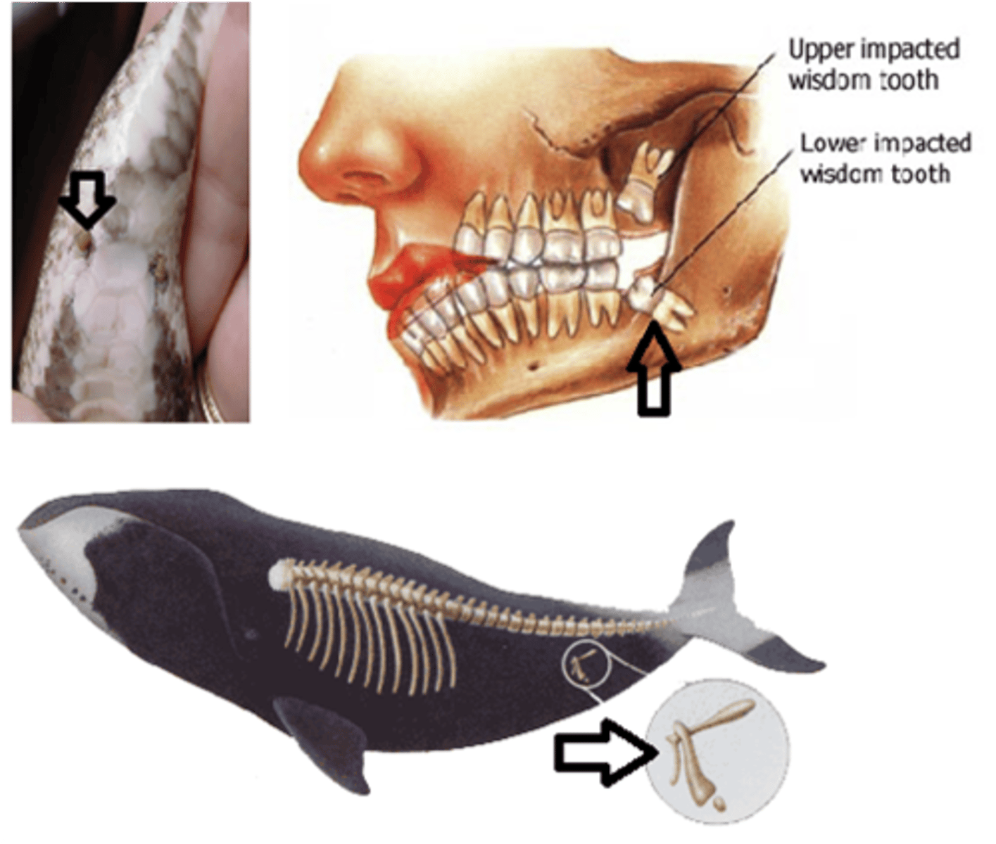 <p>body part that has lost its original function through evolution</p>