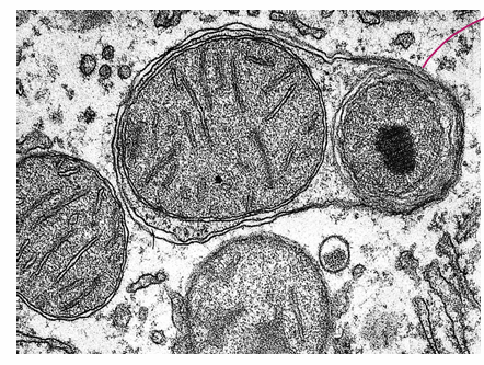 <p>the destruction pf large cellular components including entire organelles</p><ul><li><p>ER derived membrane encloses organelle </p></li><li><p>organelles digested/broken down by enzymes in LYSOSOME</p></li><li><p>** also function in plant vacuole</p></li></ul><p></p>