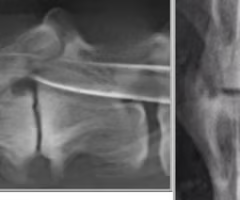 <p><span><span>Identify the pathology?</span></span></p>
