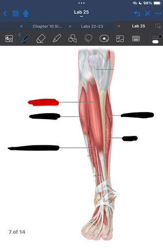 <p>What muscle is this?</p>