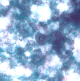 <p>Professor: Dr. Glena Fe A. Yapchulay-Alcabasa</p>