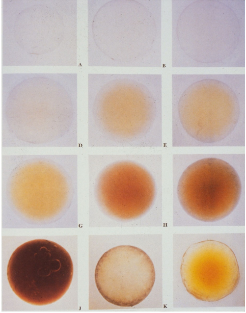 <p>change color with age (get more yellow)</p><ul><li><p>and cataracts (bottom row)</p></li></ul><p></p>