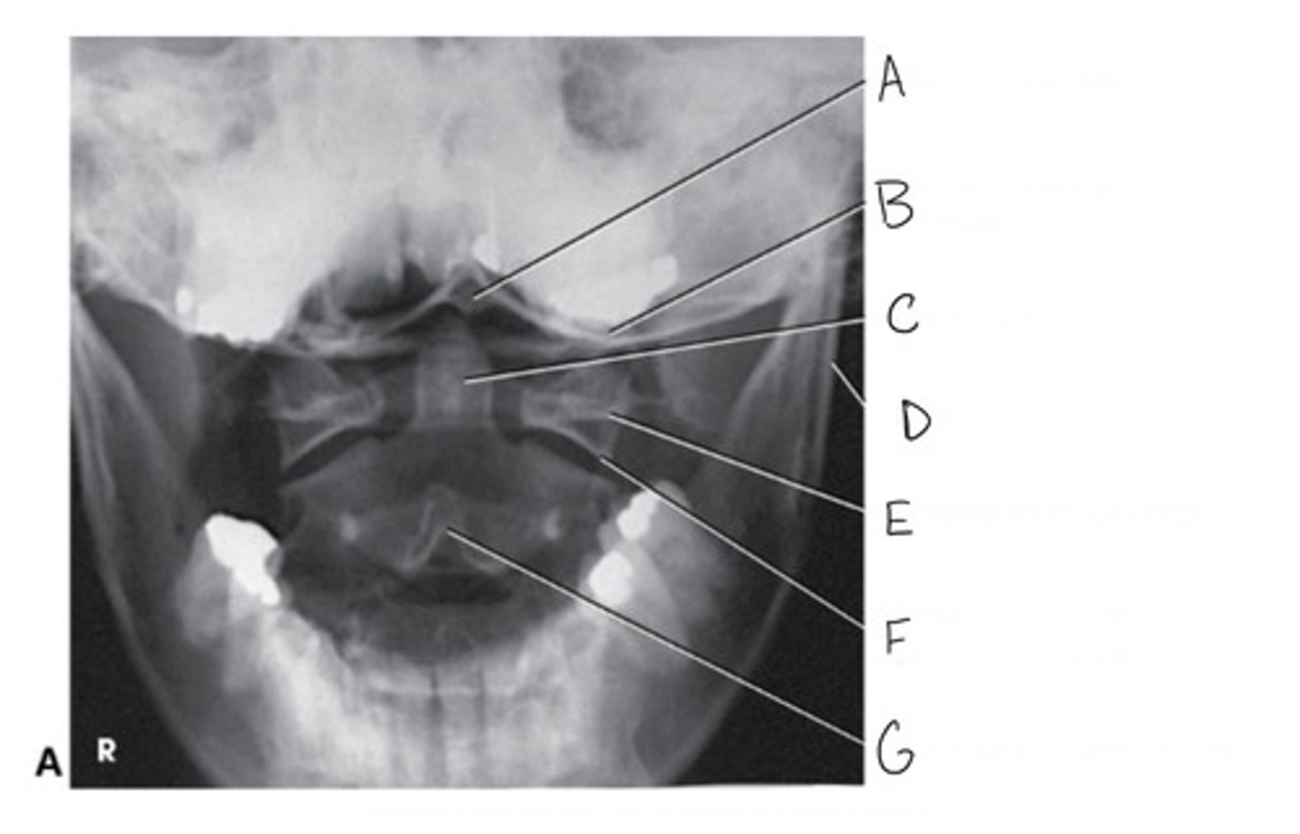 <p>What projection is this?</p>