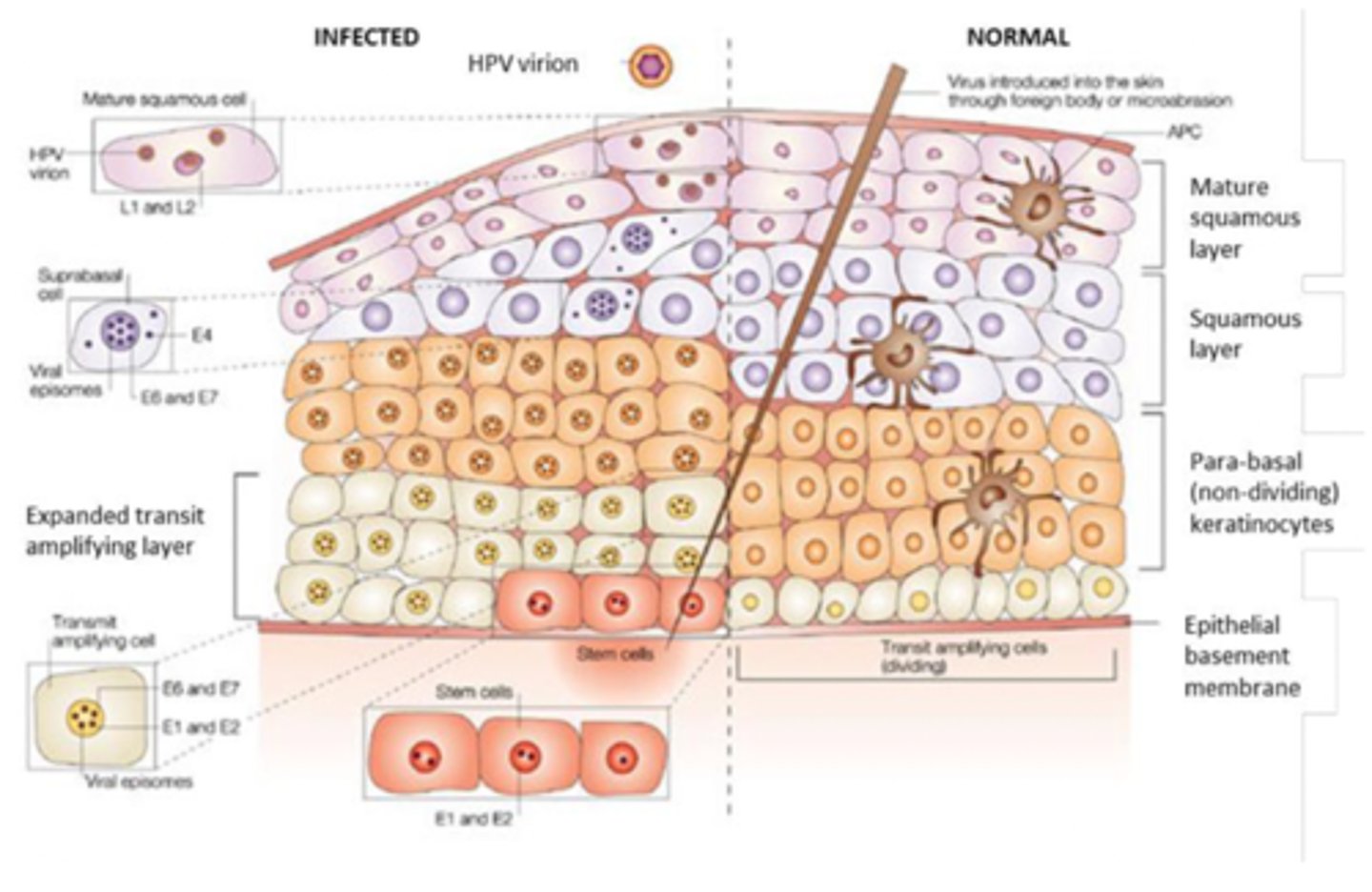<p>E6 binds and degrades p53, preventing apoptosis and DNA damage repair. E7 binds and inactivates pRb, removing cell-cycle checkpoint → uncontrolled proliferation.</p>