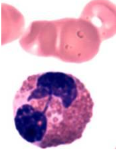 <p>Identify the key morphological features of this eosinophil.</p>