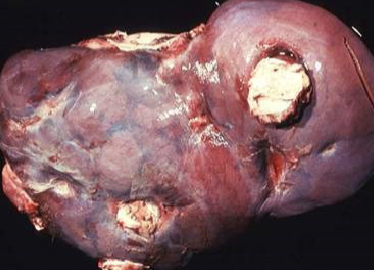 <p>Suppurative (pus forming) lesions in cattle, pigs and sheep</p>