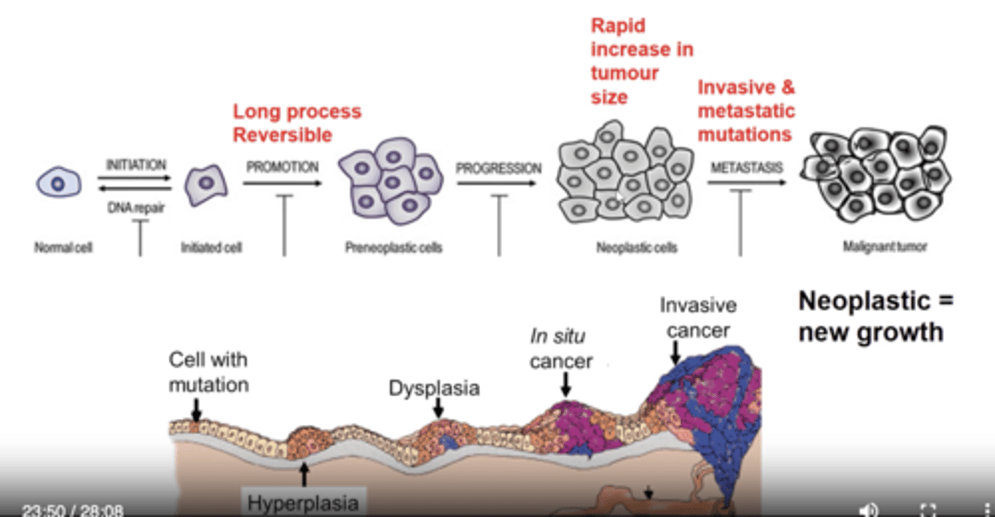 <p>Initiation, promotion, progression and metastasis.</p>